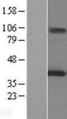 Western Blot: MAGEA12 Overexpression Lysate (Adult Normal) [NBL1-12800] Left-Empty vector transfected control cell lysate (HEK293 cell lysate); Right -Over-expression Lysate for MAGEA12.