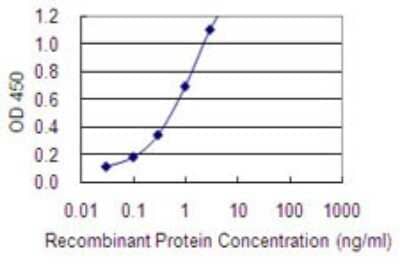 Sandwich ELISA MAGEA2 Antibody (1H4)