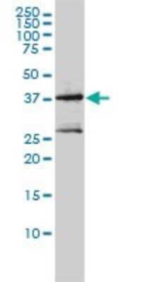 Western Blot MAGEA2 Antibody (1H4)