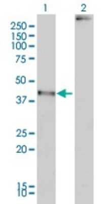 Western Blot MAGEA2 Antibody (1H4)