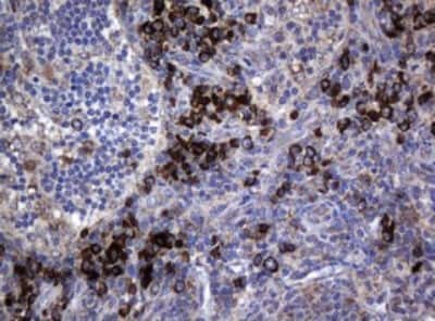 Immunohistochemistry: MAGEA3 Antibody (1G9) [NBP2-45719] - Analysis of Human lymph node tissue. (Heat-induced epitope retrieval by 10mM citric buffer, pH6.0, 120C for 3min)