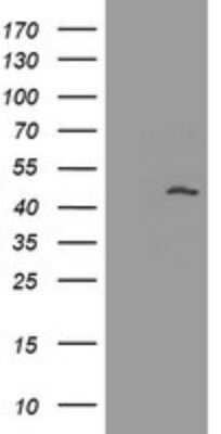 Western Blot: MAGEA3 Antibody (1G9) [NBP2-45719] - Analysis of HEK293T cells were transfected with the pCMV6-ENTRY control (Left lane) or pCMV6-ENTRY MAGEA3.