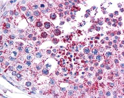 Immunohistochemistry-Paraffin: MAGEA3 Antibody [NBP1-56404] - Human testis tissue at an antibody concentration of 4-8ug/ml.