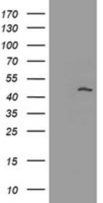 Western Blot: MAGEA3 Antibody (OTI1G9) - Azide and BSA Free [NBP2-72570] - Analysis of HEK293T cells were transfected with the pCMV6-ENTRY control (Left lane) or pCMV6-ENTRY MAGEA3.