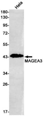 Western Blot: MAGEA3 Antibody (S07-8A2) [NBP3-19683] - Western blot detection of MAGEA3 in Hela cell lysates using NBP3-19683 (1:1000 diluted). Predicted band size: 35kDa. Observed band size: 45kDa.