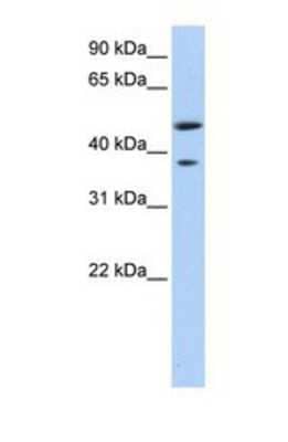 Western Blot: MAGEA3 Antibody [NBP1-56404] - This Anti-MAGEA3 antibody was used in Western Blot of Fetal Liver tissue lysate at a concentration of 1ug/ml.