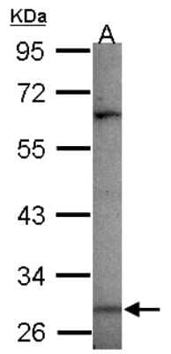 Western Blot: MAGEA3 Antibody [NBP2-17203] - Sample (30 ug of whole cell lysate) A: A549 10% SDS PAGE gel, diluted at 1:1000.