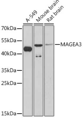 Western Blot: MAGEA3 Antibody [NBP3-15499] - Western blot analysis of extracts of various cell lines, using MAGEA3 Rabbit pAb (NBP3-15499) at 1:1000 dilution. Secondary antibody: HRP Goat Anti-Rabbit IgG (H+L) at 1:10000 dilution. Lysates/proteins: 25ug per lane. Blocking buffer: 3% nonfat dry milk in TBST. Detection: ECL Enhanced Kit. Exposure time: 90s.