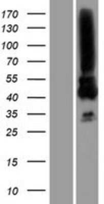 Western Blot MAGEA3 Overexpression Lysate