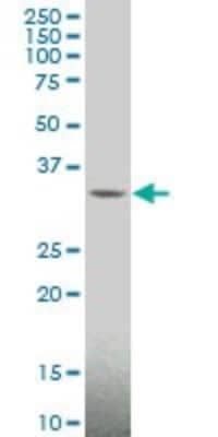 Western Blot MAGEA4 Antibody (3D12)