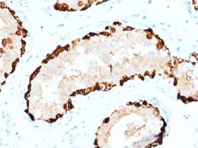 Immunohistochemistry-Paraffin: MAGEA4 Antibody (CPTC-MAGEA4-1) - Azide and BSA Free [NBP2-79861] - Formalin-fixed, paraffin-embedded human Testis stained with MAGEA4 Antibody (CPTC-MAGEA4-1).