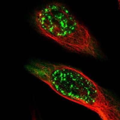 <b>Orthogonal Strategies Validation. </b>Immunocytochemistry/Immunofluorescence: MAGEA4 Antibody [NBP1-84365] - Staining of human cell line U-2 OS shows localization to nuclear speckles & cytosol. Antibody staining is shown in green.