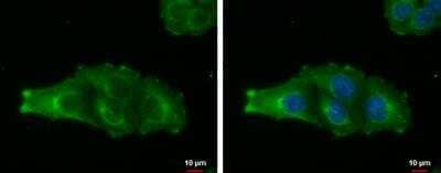 Immunocytochemistry/Immunofluorescence: MAGEA4 Antibody [NBP2-17204] - MAGEA4 antibody detects MAGEA4 protein at cytoplasm by immunofluorescent analysis. Sample: A375 cells were fixed in 4  paraformaldehyde at RT for 15 min. Green: MAGEA4 protein stained by MAGEA4 antibody diluted at 1:500. Blue: Hoechst 33342 staining. Scale bar-10 um.