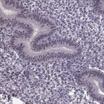 Immunohistochemistry-Paraffin: MAGEA4 Antibody [NBP1-84365] - Staining of human endometrium shows low expression as expected.