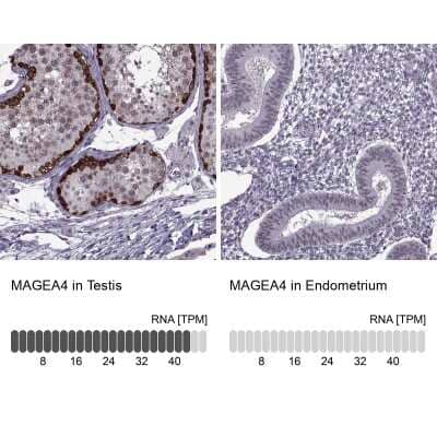 Immunohistochemistry-Paraffin: MAGEA4 Antibody [NBP1-84365] - Analysis in human testis and endometrium tissues using NBP1-84365 antibody. Corresponding MAGEA4 RNA-seq data are presented for the same tissues.