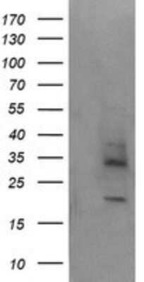 Western Blot: MAGEA4 Antibody (OTI2C1) - Azide and BSA Free [NBP2-72571] - Analysis of HEK293T cells were transfected with the pCMV6-ENTRY control (Left lane) or pCMV6-ENTRY MAGEA4.