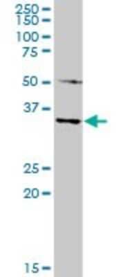 Western Blot: MAGEA4 Antibody [H00004103-D01P] - Analysis of MAGEA4 expression in mouse spleen.