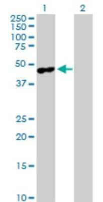 Western Blot: MAGEA4 Antibody [H00004103-D01P] - Analysis of MAGEA4 expression in transfected 293T cell line by MAGEA4 polyclonal antibody.Lane 1: MAGEA4 transfected lysate(34.90 KDa).Lane 2: Non-transfected lysate.