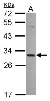 Western Blot: MAGEA4 Antibody [NBP2-17204] - Sample (30 ug of whole cell lysate) A: A549 12% SDS PAGE gel, diluted at 1:2000.