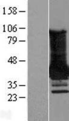 Western Blot: MAGEA4 Overexpression Lysate (Adult Normal) [NBL1-12803] Left-Empty vector transfected control cell lysate (HEK293 cell lysate); Right -Over-expression Lysate for MAGEA4.