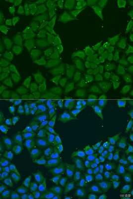 Immunocytochemistry/ Immunofluorescence MAGEA6 Antibody - BSA Free