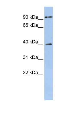 Western Blot: MAGEA6 Antibody [NBP1-56603] - Jurkat cell lysate, concentration 0.2-1 ug/ml.