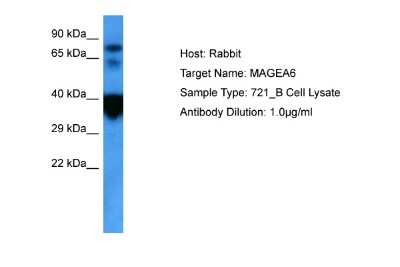Western Blot: MAGEA6 Antibody [NBP2-84152] - Host: Rabbit. Target Name: MAGEA6. Sample Tissue: Human 721_B lymphoblast Whole Cell. Antibody Dilution: 1.0ug/ml