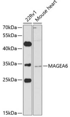 Western Blot MAGEA6 Antibody - BSA Free