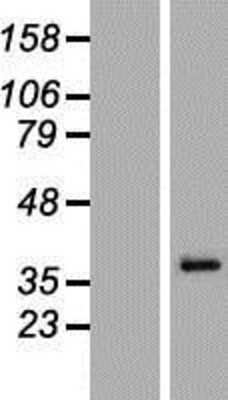 Western Blot: MAGEA6 Overexpression Lysate (Adult Normal) [NBP2-05042] Left-Empty vector transfected control cell lysate (HEK293 cell lysate); Right -Over-expression Lysate for MAGEA6.