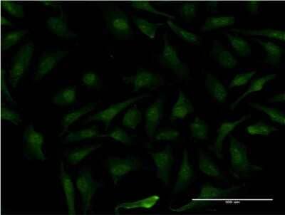 Immunocytochemistry/Immunofluorescence: MAGEB1 Antibody (3C1) [H00004112-M09] - Analysis of monoclonal antibody to MAGEB1 on HeLa cell. Antibody concentration 10 ug/ml