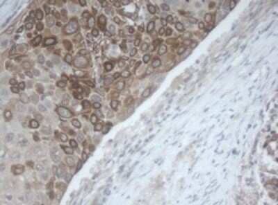 Immunohistochemistry MAGEB1 Antibody (OTI4E12)