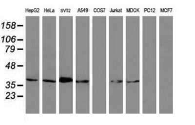 Western Blot MAGEB1 Antibody (OTI4E12)