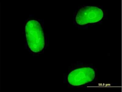 Immunocytochemistry/Immunofluorescence: MAGEB1 Antibody [H00004112-B01P] - Analysis of purified antibody to MAGEB1 on Hs 181.Tes cell. (antibody concentration 10 ug/ml)