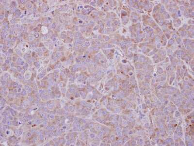 Immunohistochemistry-Paraffin: MAGEB1 Antibody [NBP1-32231] - Paraffin-embedded MCF-7 xenograft; antibody dilution 1:500.