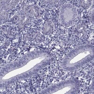 <b>Orthogonal Strategies Validation. </b>Immunohistochemistry-Paraffin: MAGEB1 Antibody [NBP1-85405] - Staining of human endometrium shows low expression as expected.