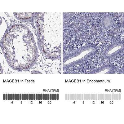 Immunohistochemistry-Paraffin: MAGEB1 Antibody [NBP1-85405] - Staining in human testis and endometrium tissues using anti-MAGEB1 antibody. Corresponding MAGEB1 RNA-seq data are presented for the same tissues.