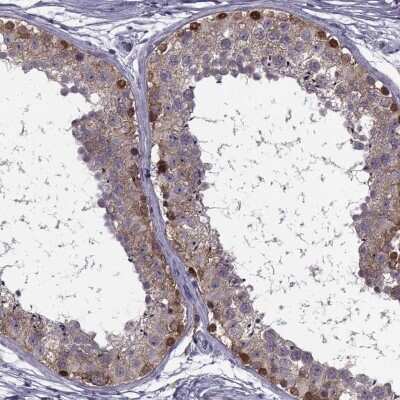 Immunohistochemistry-Paraffin: MAGEB1 Antibody [NBP1-85406] - Staining of human testis shows strong cytoplasmic positivity in spermatogonia.