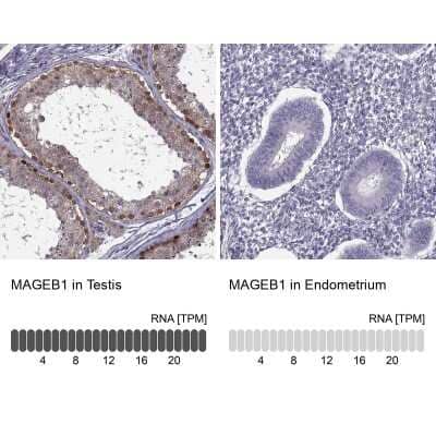 Immunohistochemistry-Paraffin: MAGEB1 Antibody [NBP1-85406] - Analysis in human testis and endometrium tissues using NBP1-85406 antibody. Corresponding MAGEB1 RNA-seq data are presented for the same tissues.