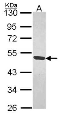 Western Blot: MAGEB1 Antibody [NBP1-32231] - Sample (30 ug of whole cell lysate) A: H1299 10% SDS PAGE MAGEB1 antibody, antibody diluted at 1:1000.