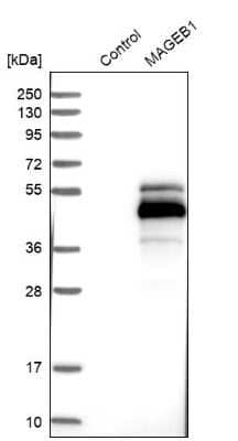 Western Blot: MAGEB1 Antibody [NBP1-85406] - Analysis in control (vector only transfected HEK293T lysate) and MAGEB1 over-expression lysate (Co-expressed with a C-terminal myc-DDK tag (3.1 kDa) in mammalian HEK293T cells).