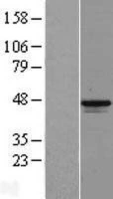 Western Blot: MAGEB1 Overexpression Lysate (Adult Normal) [NBP2-05034] Left-Empty vector transfected control cell lysate (HEK293 cell lysate); Right -Over-expression Lysate for MAGEB1.