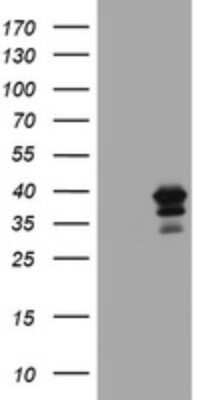 Western Blot: MAGEB18 Antibody (OTI1H2) - Azide and BSA Free [NBP2-72577] - Analysis of HEK293T cells were transfected with the pCMV6-ENTRY control (Left lane) or pCMV6-ENTRY MAGEB18.