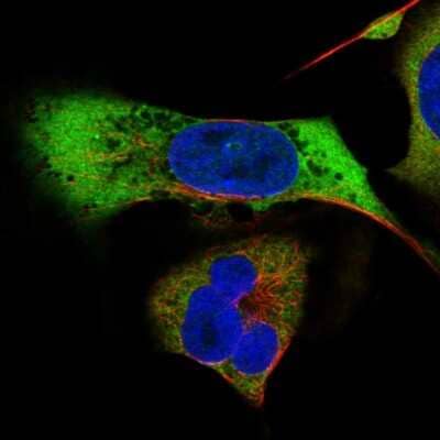 Immunocytochemistry/Immunofluorescence: MAGEB2 Antibody [NBP2-57072] - Staining of human cell line U-2 OS shows localization to cytosol.