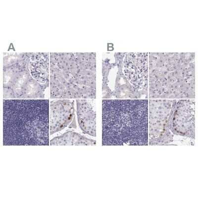 Immunohistochemistry-Paraffin: MAGEB2 Antibody [NBP2-62688] - Staining of human kidney, liver, lymph node and testis using Anti-MAGEB2 antibody NBP2-62688 (A) shows similar protein distribution across tissues to independent antibody NBP2-62697 (B).