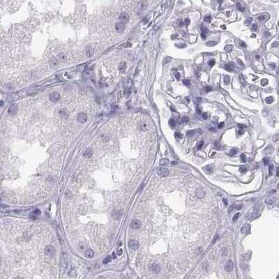 Immunohistochemistry-Paraffin: MAGEB2 Antibody [NBP2-62688] - Staining of human kidney.