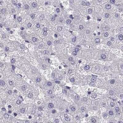 Immunohistochemistry-Paraffin: MAGEB2 Antibody [NBP2-62688] - Staining of human liver.