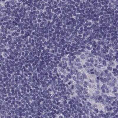 Immunohistochemistry-Paraffin: MAGEB2 Antibody [NBP2-62688] - Staining of human lymph node.