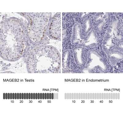 <b>Orthogonal Strategies Validation. </b>Immunohistochemistry-Paraffin: MAGEB2 Antibody [NBP2-62697] - Analysis in human testis and endometrium tissues using Anti-MAGEB2 antibody. Corresponding MAGEB2 RNA-seq data are presented for the same tissues.