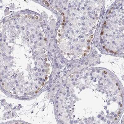 Immunohistochemistry-Paraffin: MAGEB2 Antibody [NBP2-62697] - Staining of human testis shows high expression.