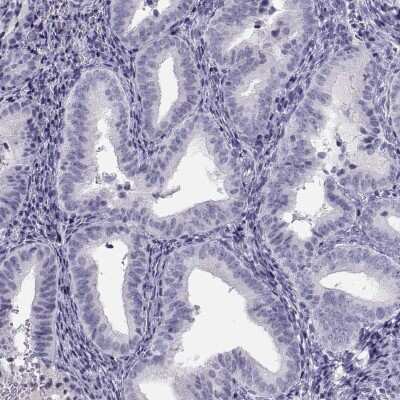 Immunohistochemistry-Paraffin: MAGEB2 Antibody [NBP2-62697] - Staining of human endometrium shows low expression as expected.